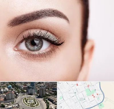 فوق تخصص عنبیه در زرافشان اسلامشهر