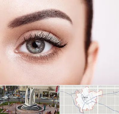 فوق تخصص عنبیه در زابل