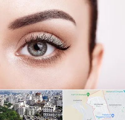 فوق تخصص عنبیه در ولنجک 