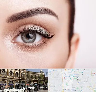 فوق تخصص عنبیه در منطقه 11 تهران 