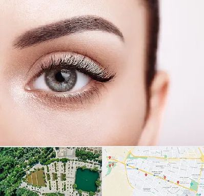 فوق تخصص عنبیه در وکیل آباد مشهد 