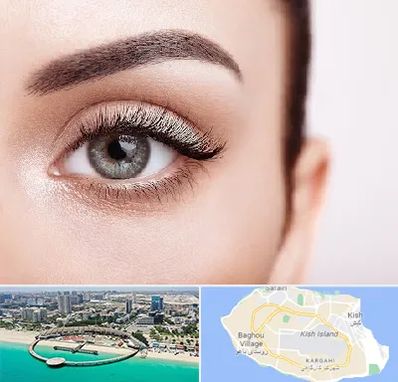 فوق تخصص عنبیه در کیش