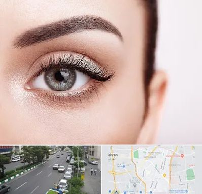 فوق تخصص عنبیه در ستارخان 