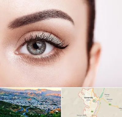 فوق تخصص عنبیه در سنندج