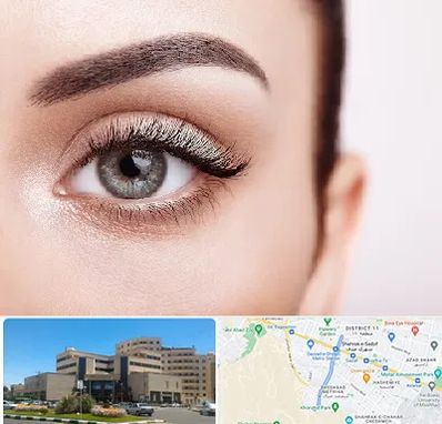 فوق تخصص عنبیه در صیاد شیرازی مشهد