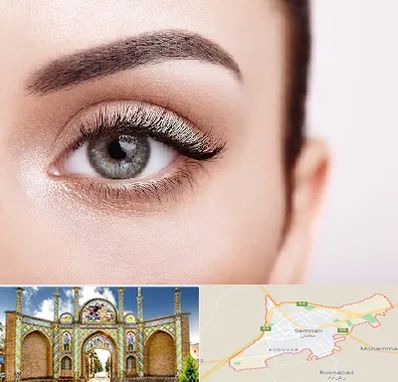 فوق تخصص عنبیه در سمنان