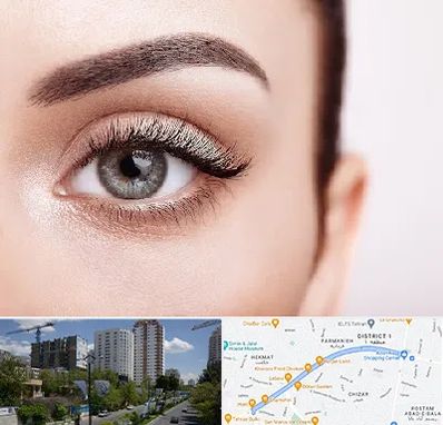 فوق تخصص عنبیه در اندرزگو