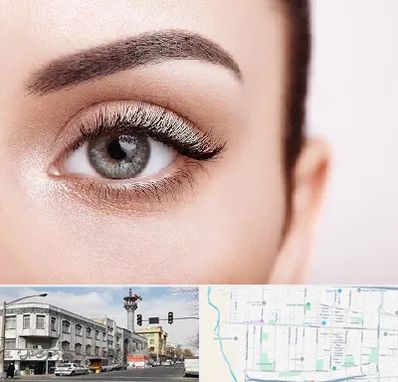 فوق تخصص عنبیه در 17شهریور