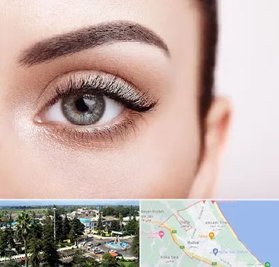 فوق تخصص عنبیه در رودسر