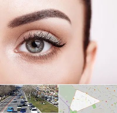 فوق تخصص عنبیه در احمدآباد مشهد 