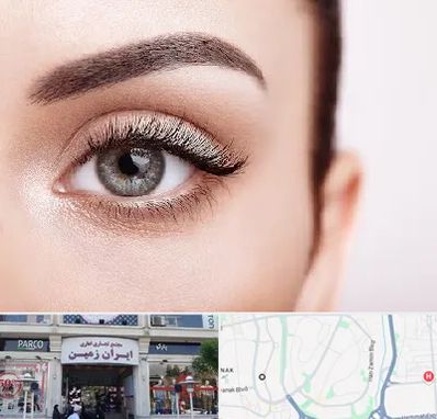 فوق تخصص عنبیه در ایران زمین