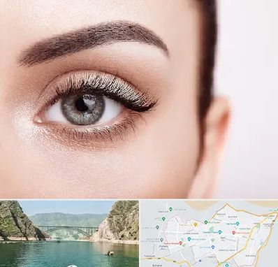 فوق تخصص عنبیه در ایلام