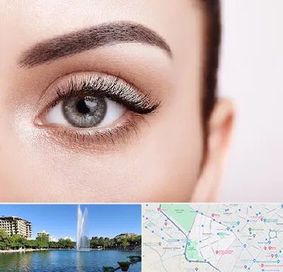 فوق تخصص عنبیه در کوهسنگی مشهد