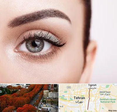 فوق تخصص عنبیه در ولیعصر 