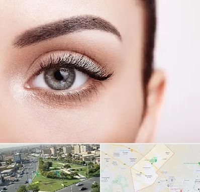 فوق تخصص عنبیه در کمال شهر کرج 