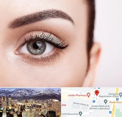 فوق تخصص عنبیه در جردن 