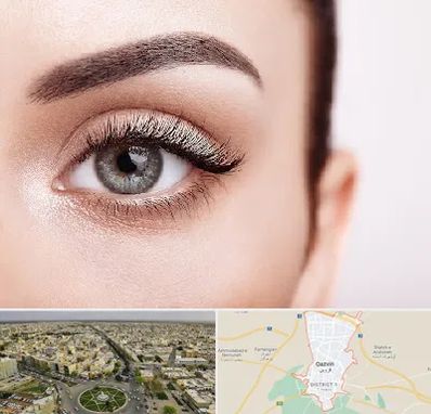 فوق تخصص عنبیه در قزوین