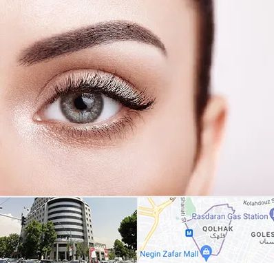 فوق تخصص عنبیه در قلهک 