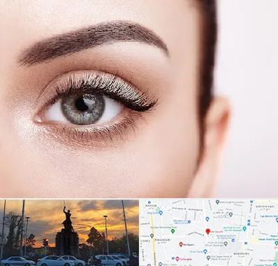 فوق تخصص عنبیه در میدان حر 