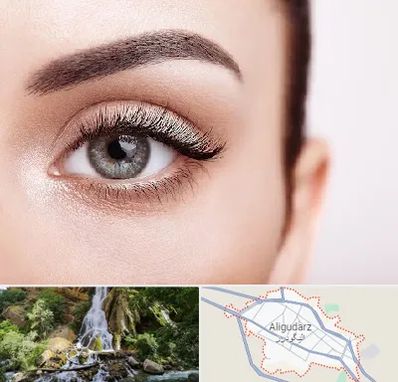 فوق تخصص عنبیه در الیگودرز