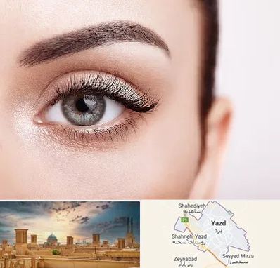 فوق تخصص عنبیه در یزد