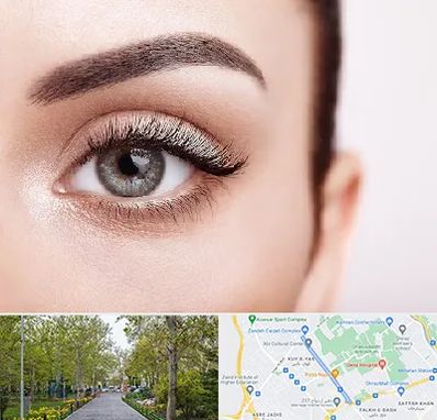 فوق تخصص عنبیه در قدوسی غربی شیراز