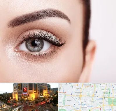 فوق تخصص عنبیه در جنت آباد تهران 