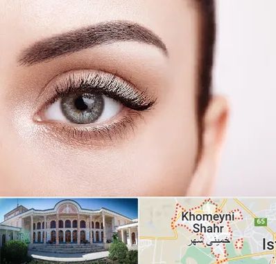 فوق تخصص عنبیه در خمینی شهر