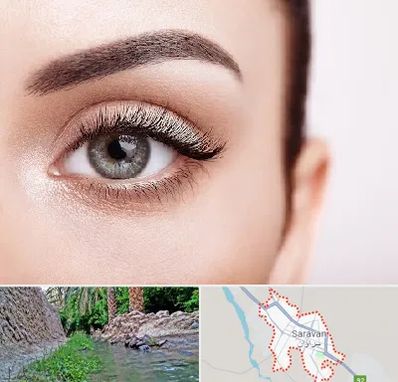 فوق تخصص عنبیه در سراوان