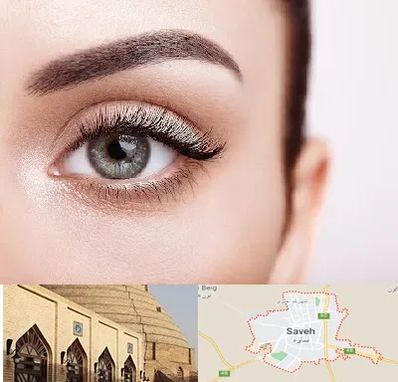 فوق تخصص عنبیه در ساوه