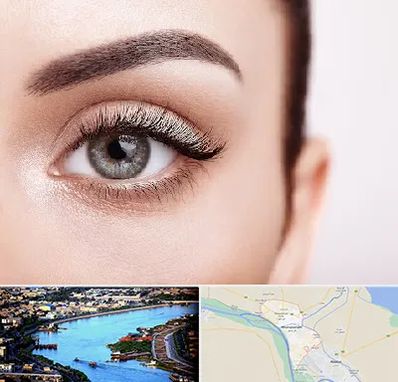 فوق تخصص عنبیه در خرمشهر