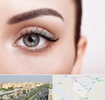 فوق تخصص عنبیه در کیانمهر کرج