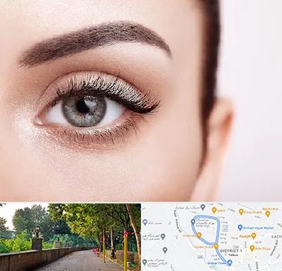 فوق تخصص عنبیه در فلکه گاز رشت