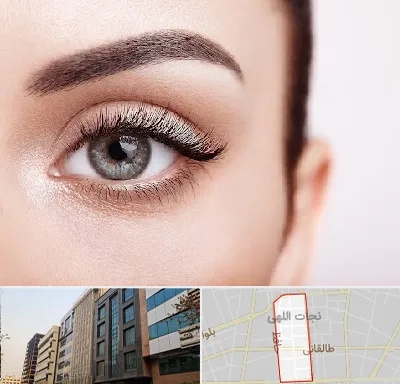 فوق تخصص عنبیه در نجات اللهی