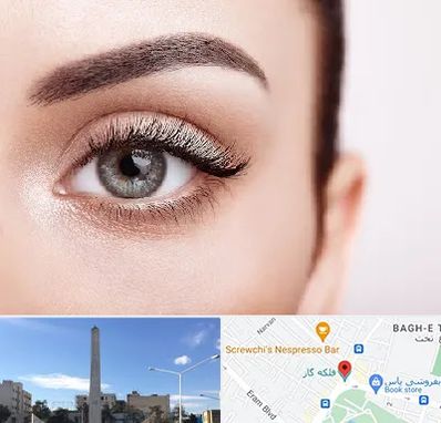 فوق تخصص عنبیه در فلکه گاز شیراز