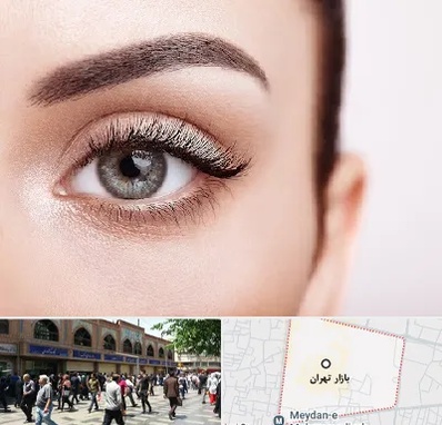 فوق تخصص عنبیه در بازار تهران