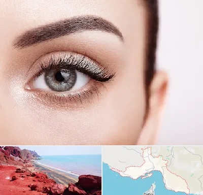 فوق تخصص عنبیه در هرمزگان