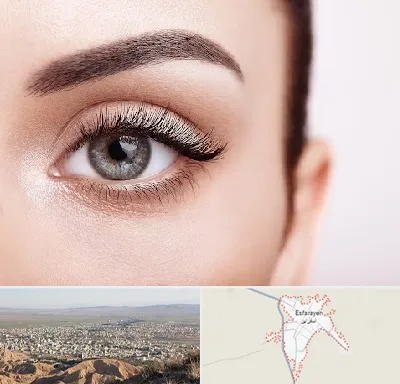 فوق تخصص عنبیه در اسفراین