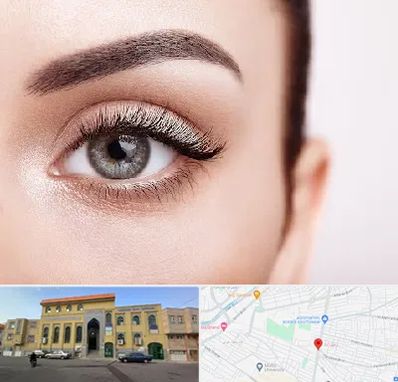 فوق تخصص عنبیه در زنبیل آباد قم