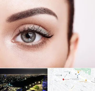 فوق تخصص عنبیه در هفت تیر مشهد 