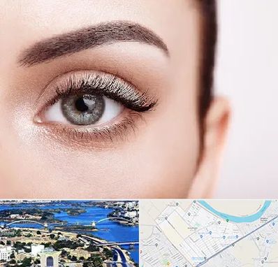 فوق تخصص عنبیه در کوروش اهواز