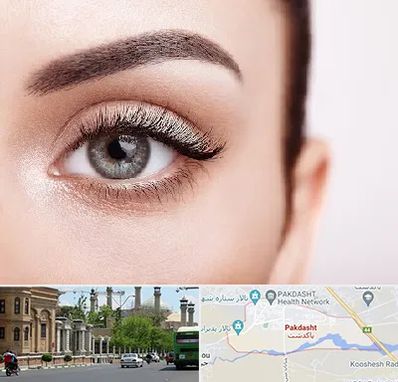 فوق تخصص عنبیه در پاکدشت