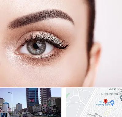 فوق تخصص عنبیه در چهارراه طالقانی کرج