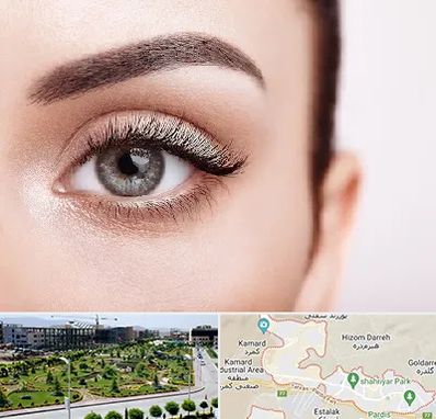 فوق تخصص عنبیه در پردیس