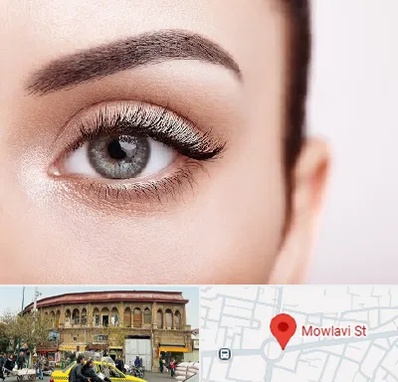 فوق تخصص عنبیه در مولوی