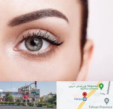 فوق تخصص عنبیه در هروی 