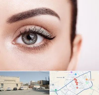 فوق تخصص عنبیه در نواب اسلامشهر