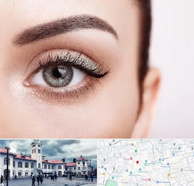 فوق تخصص عنبیه در میدان شهرداری رشت