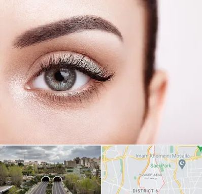 فوق تخصص عنبیه در یوسف آباد 