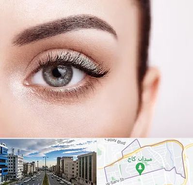 فوق تخصص عنبیه در سعادت آباد 